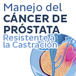 cáncer de próstata-1